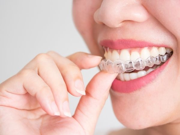 Invisalign Leeds Scholes Dental Care